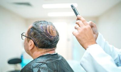 Hair Transplant